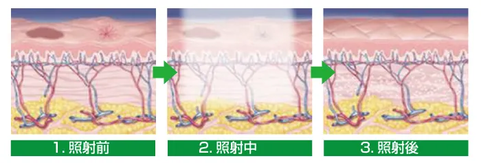 メカニズム