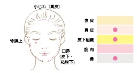 ヒアルロンイラスト1