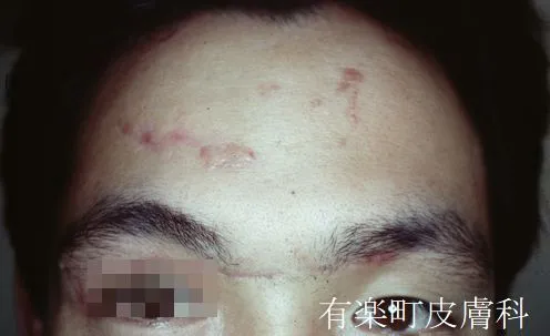 外傷8