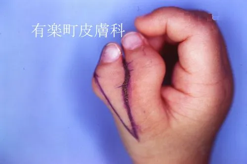 手指手足2