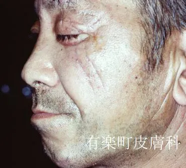 外傷9