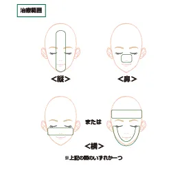 治療範囲図