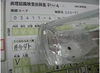 治療後3