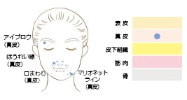 ヒアルロンイラスト2