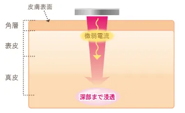 イオン導入とは