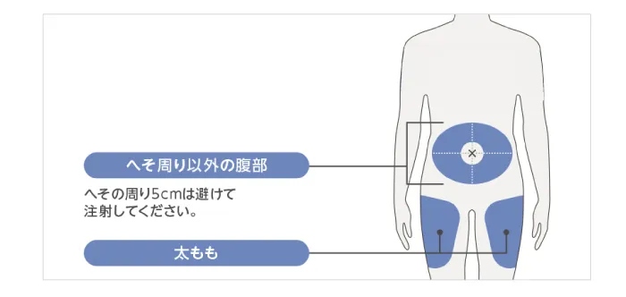 デュクピクセント投与について