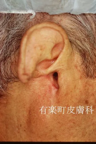 顎顔面骨再建1