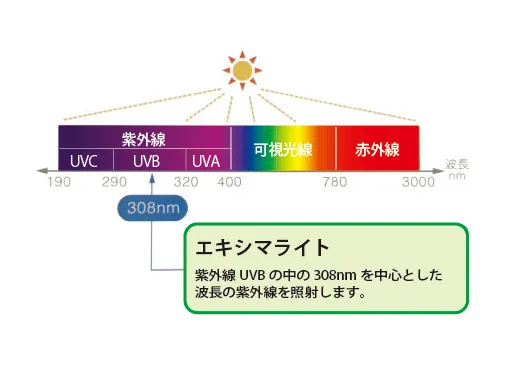 紫外線療法(光線療法)とは?
