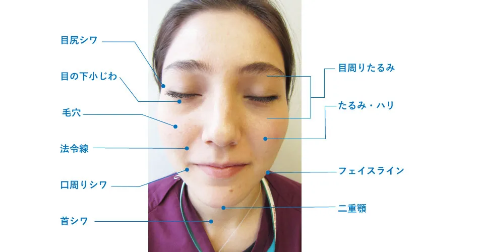 有楽町HIFUおすすめ部位