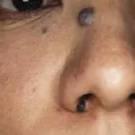 症例1