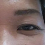 症例4