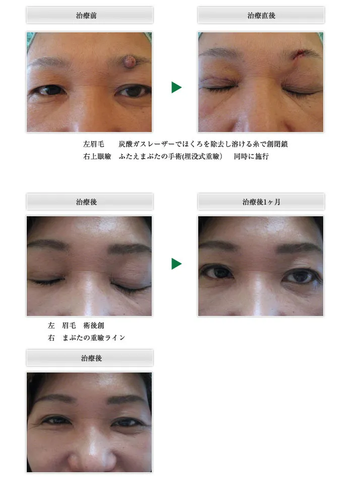 症例5