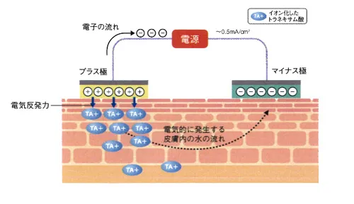 イオン導入の原理(トラネキサム酸の例)