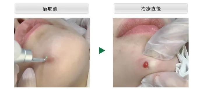 症例①